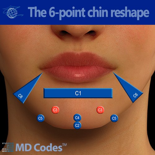 6 Point Chin Reshape