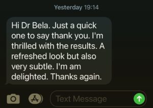 Dermal filler testimonial