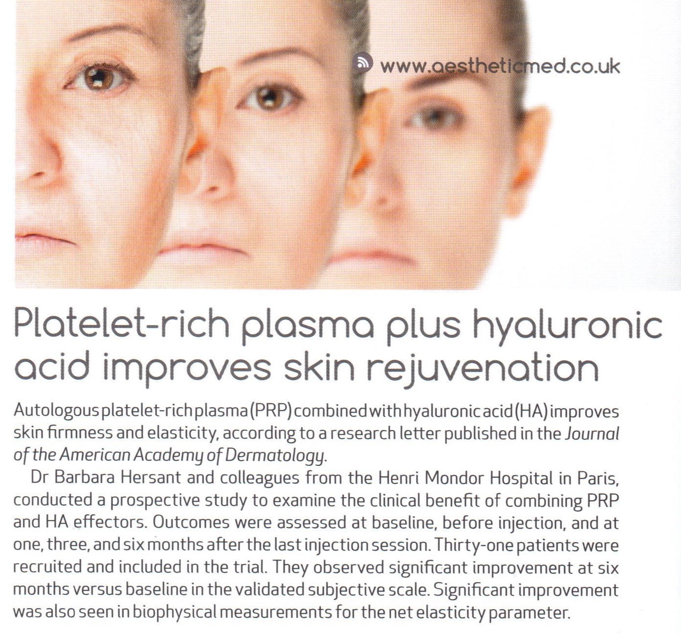 PRP dermal fillers