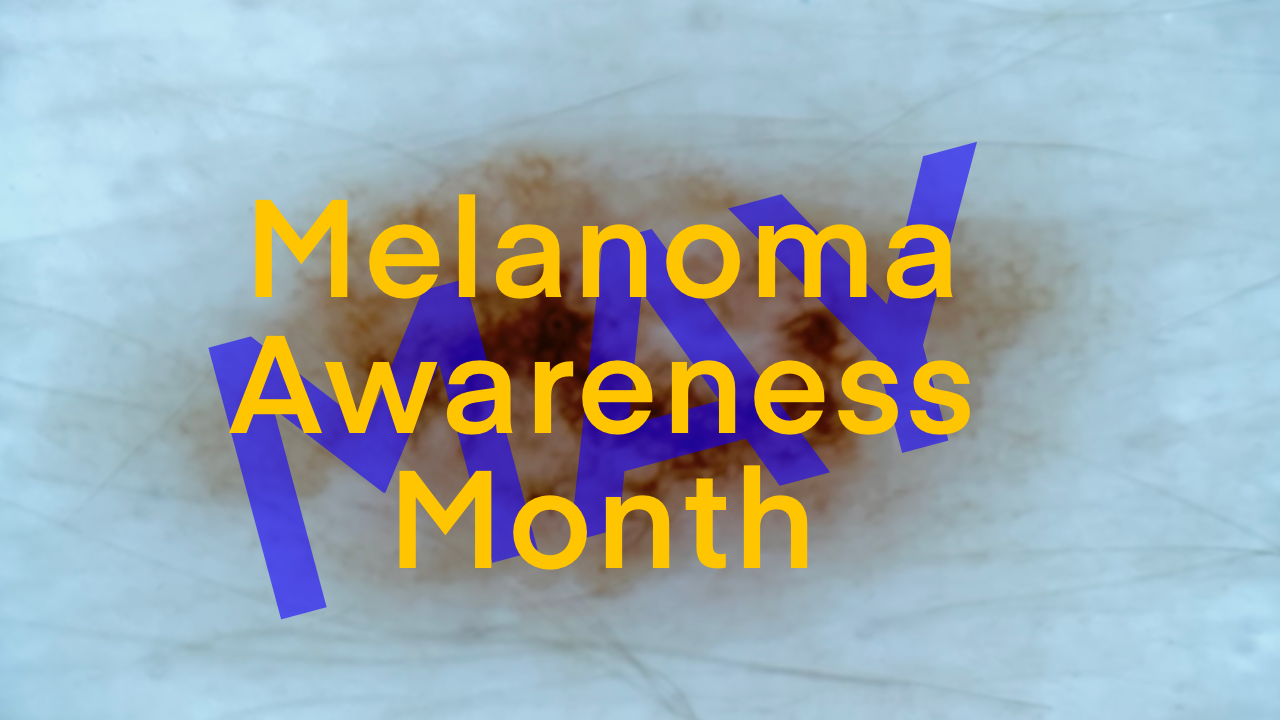 Melanoma awareness month - Dr Bela Clinic